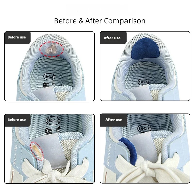 6Pcs Shoe Repair Patches Anti  - đánh giá và giá Life Sneaker Care